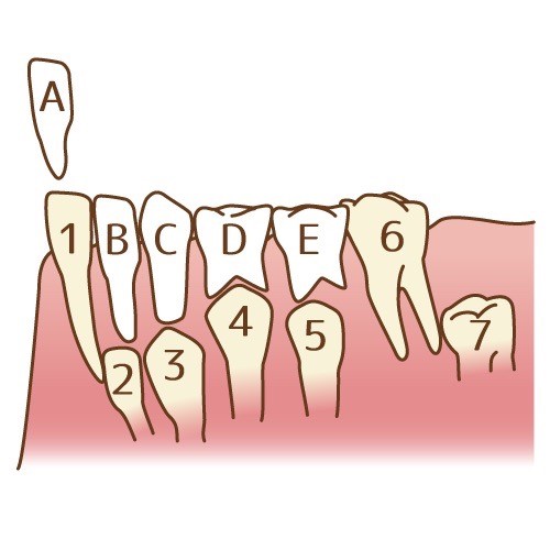 グラグラして抜けそうな乳歯どうしたらいいの 四日市市の歯医者のブログ にいみ歯科医院
