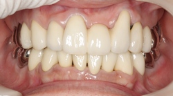 湊 美智代_2012.12.12_L108-thumb-250x139-209