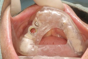 エールガイド2015.07.07_L003-thumb-300x200-758