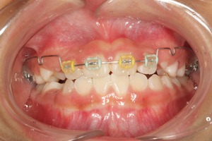 神山 叡亜_2014.07.28_L189-thumb-300x200-817