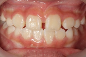 神山 叡亜_2013.06.21_L107-thumb-300x200-815