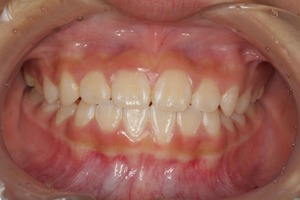 神山 叡亜_2015.11.30_L252-thumb-300x200-819