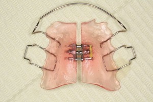 神山 叡亜_2012.07.23_L034-thumb-300x200-813