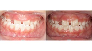 ea1-thumb-300x168-811