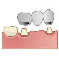 crown015-thumb-200x200-839