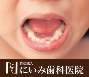 三重県四日市_にいみ歯科医院_乳歯_幼児