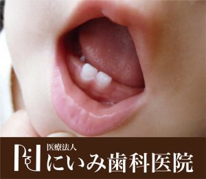 三重県四日市_にいみ歯科医院_乳歯_乳児