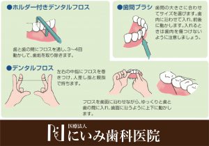 三重県四日市_にいみ歯科医院_口臭_ブラッシング3
