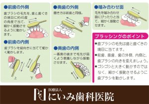 三重県四日市_にいみ歯科医院_口臭_ブラッシング1