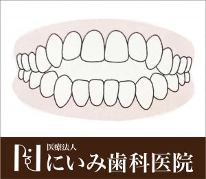 三重県四日市_にいみ歯科医院_噛み合わせ2
